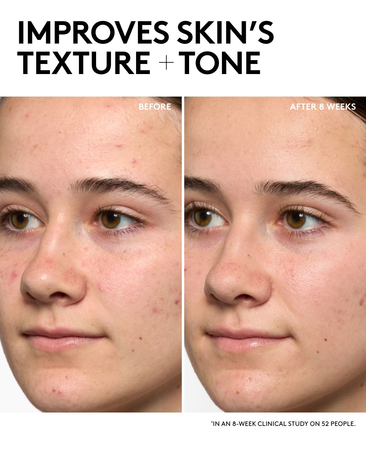 Arcane Hydra Vizor Mystery Box Moisturizer Sunscreen + Collector's Case